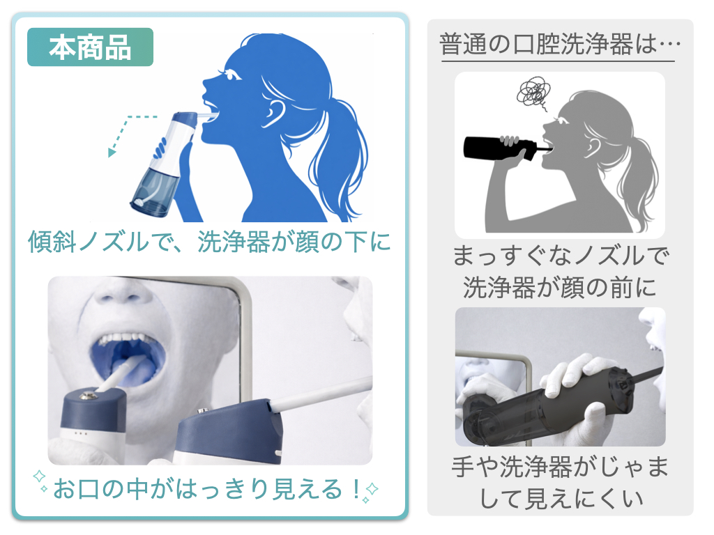 ななめノズルと通常の口腔洗浄器を使用した際の見え方の比較